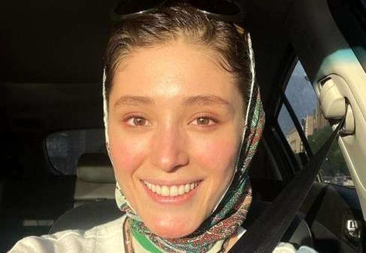 عکس فرشته حسینی با چشم کبود که حسابی وایرال شد!